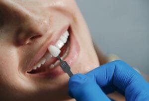 Types of Dental Implants